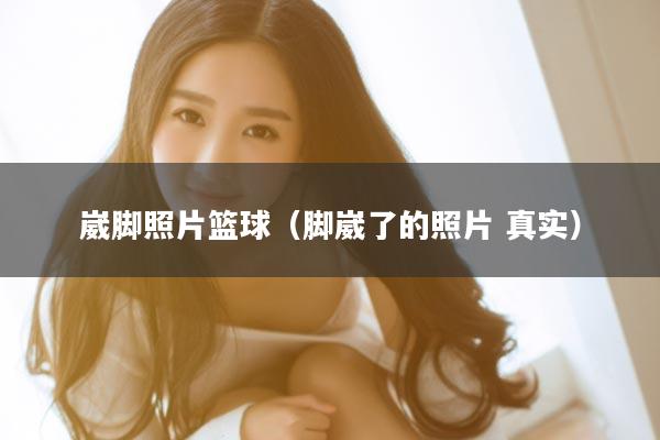 崴脚照片篮球(脚崴了的照片 真实)